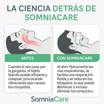 SomniaCare® Férula Antirronquidos Nocturna